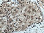 TLK2 Antibody in Immunohistochemistry (Paraffin) (IHC (P))