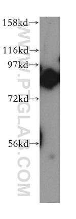 TLK2 Antibody in Western Blot (WB)