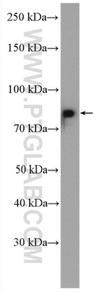 TLK2 Antibody in Western Blot (WB)