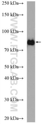 TLK2 Antibody in Western Blot (WB)