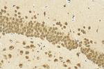 YAF2 Antibody in Immunohistochemistry (Paraffin) (IHC (P))