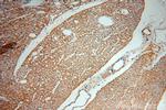 PCAF Antibody in Immunohistochemistry (Paraffin) (IHC (P))