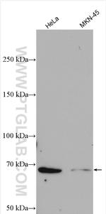 TRAK1 Antibody in Western Blot (WB)