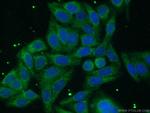 ACSL1 Antibody in Immunocytochemistry (ICC/IF)