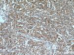 ACSL1 Antibody in Immunohistochemistry (Paraffin) (IHC (P))