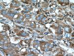 ACSL1 Antibody in Immunohistochemistry (Paraffin) (IHC (P))