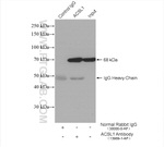 ACSL1 Antibody in Immunoprecipitation (IP)