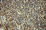 GRK2 Antibody in Immunohistochemistry (Paraffin) (IHC (P))