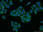 LEFTY2 Antibody in Immunocytochemistry (ICC/IF)