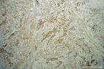 LEFTY2 Antibody in Immunohistochemistry (Paraffin) (IHC (P))