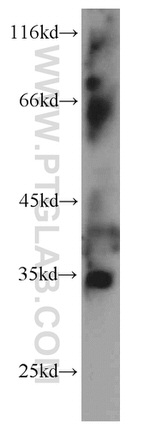 LEFTY2 Antibody in Western Blot (WB)
