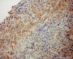NEDD1 Antibody in Immunohistochemistry (Paraffin) (IHC (P))
