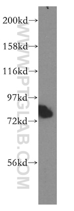 NEDD1 Antibody in Western Blot (WB)