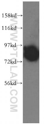 NEDD1 Antibody in Western Blot (WB)