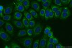 MTSS1 Antibody in Immunocytochemistry (ICC/IF)