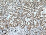 MTSS1 Antibody in Immunohistochemistry (Paraffin) (IHC (P))
