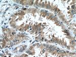 MTSS1 Antibody in Immunohistochemistry (Paraffin) (IHC (P))