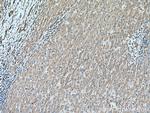 MTSS1 Antibody in Immunohistochemistry (Paraffin) (IHC (P))