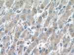 MTSS1 Antibody in Immunohistochemistry (Paraffin) (IHC (P))
