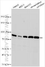 MTSS1 Antibody in Western Blot (WB)