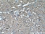 PARD6B Antibody in Immunohistochemistry (Paraffin) (IHC (P))