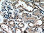 PARD6B Antibody in Immunohistochemistry (Paraffin) (IHC (P))