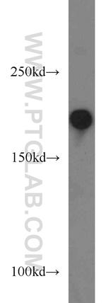 ALS2 Antibody in Western Blot (WB)