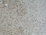 OLIG2 Antibody in Immunohistochemistry (Paraffin) (IHC (P))