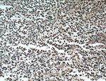 OLIG2 Antibody in Immunohistochemistry (Paraffin) (IHC (P))