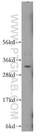 OLIG2 Antibody in Western Blot (WB)