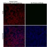 CD20 Antibody in Immunohistochemistry (Paraffin) (IHC (P))