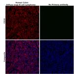 CD20 Antibody in Immunohistochemistry (Paraffin) (IHC (P))