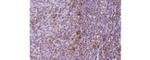 CD25 Antibody in Immunohistochemistry (Paraffin) (IHC (P))