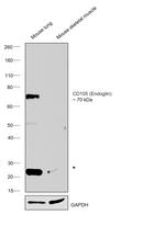 CD105 (Endoglin) Antibody