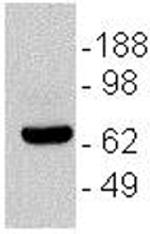 CD196 (CCR6) Monoclonal Antibody (R6H1), eBioscience™