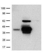 CD207 (Langerin) Antibody in Western Blot (WB)