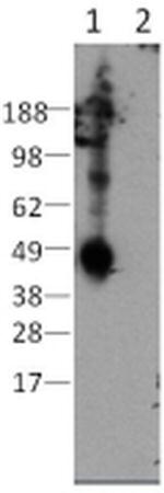 CD207 (Langerin) Monoclonal Antibody (eBioL31), eBioscience™