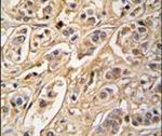 14-3-3 zeta Antibody in Immunohistochemistry (IHC)