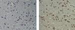 Mouse IgG1 kappa Isotype Control in Immunohistochemistry (Paraffin) (IHC (P))