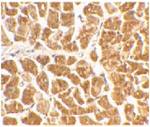 CX3CR1 Polyclonal Antibody, eBioscience™