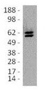 TOX Antibody in Western Blot (WB)