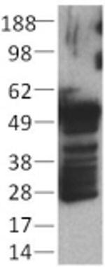 Cytokeratin Pan Type II Monoclonal Antibody (AE3), eBioscience™