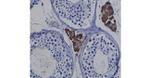 MERTK Antibody in Immunohistochemistry (Paraffin) (IHC (P))