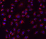 PAR2 Monoclonal Antibody (SAM11), eBioscience™