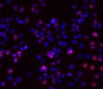 Progesterone Receptor Monoclonal Antibody (KMC912), eBioscience™