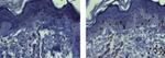 RUNX3 Antibody in Immunohistochemistry (Paraffin) (IHC (P))