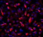 Nestin Antibody in Immunocytochemistry (ICC/IF)