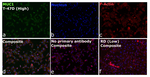 CD227 (Mucin 1) Antibody