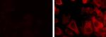 Cytokeratin 19 Monoclonal Antibody (BA17), eBioscience™