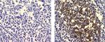 FDC Antibody in Immunohistochemistry (Paraffin) (IHC (P))